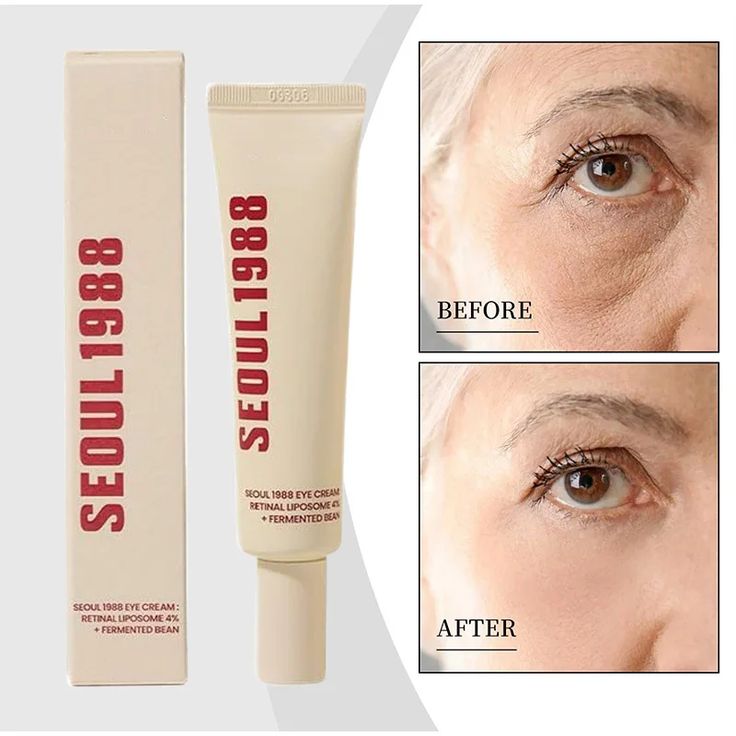 SEOUL 1988 Eye Cream